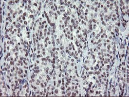 ZBED1 / TRAMP Antibody (clone OTI2A7)