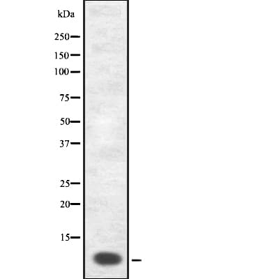 GNRH Antibody