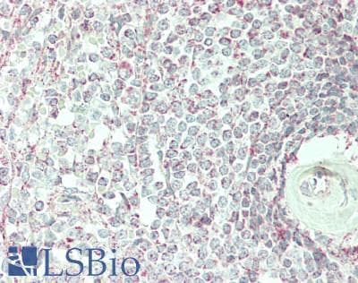 IHC-plus™ ATP5B / ATP Synthase Beta Antibody (clone 5G2)