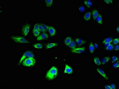 Polyclonal Rabbit anti-Human CNIH4 / HSPC163 Antibody (IHC, WB)
