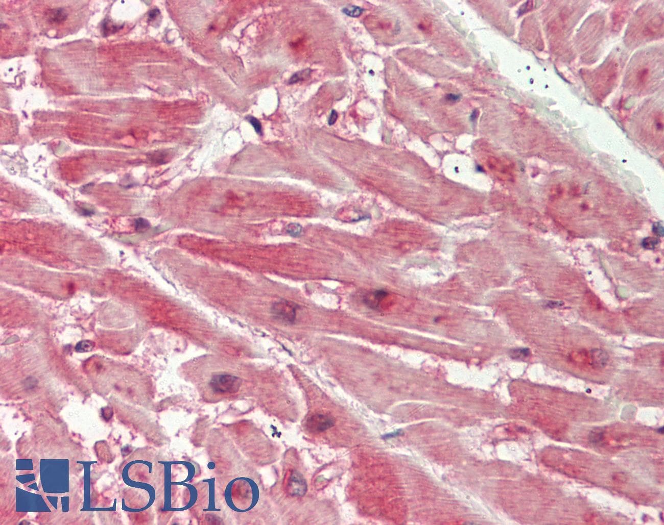 IHC-plus™ Dipeptidylpeptidase 8 / DPP8 Antibody (aa161-245)