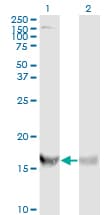RPS19 / Ribosomal Protein S19 Antibody (clone 3C6)