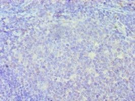 ICSBP / IRF8 Antibody (aa137-426)
