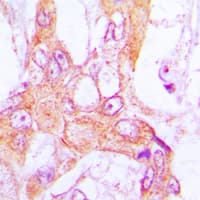 PDLIM1 Antibody (Internal)