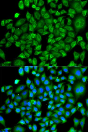Polyclonal Rabbit anti-Human NAA50 / NAT13 / SAN Antibody (IHC, IF, WB)