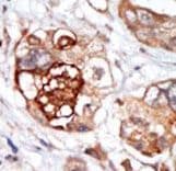 MPS1 / TTK Antibody (aa2-32)