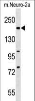 RAD50 Antibody (aa911-938)