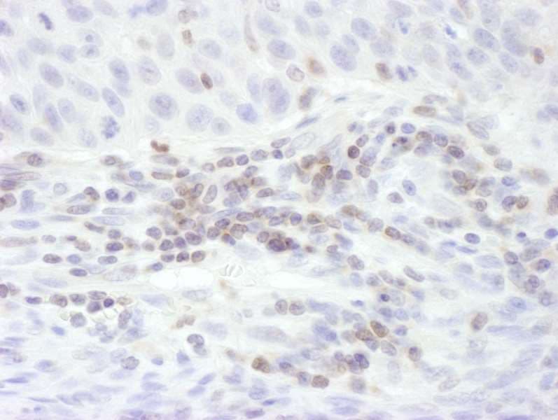 STAT5B Antibody (aa737-787)