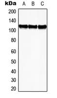 Polyclonal Rabbit anti-Human EPHB3 / EPH Receptor B3 Antibody (Internal, WB)