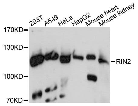 MACS / RIN2 Antibody