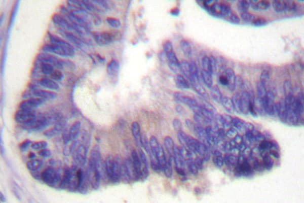 PDE4D Antibody (His47)