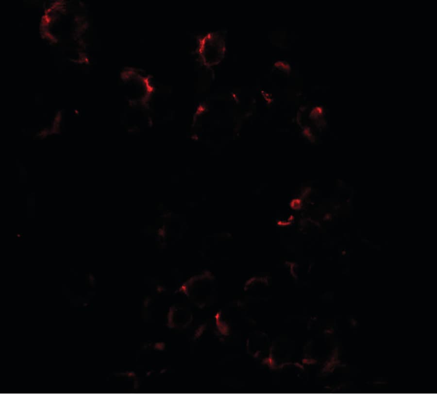 DLK1 / Pref-1 Antibody