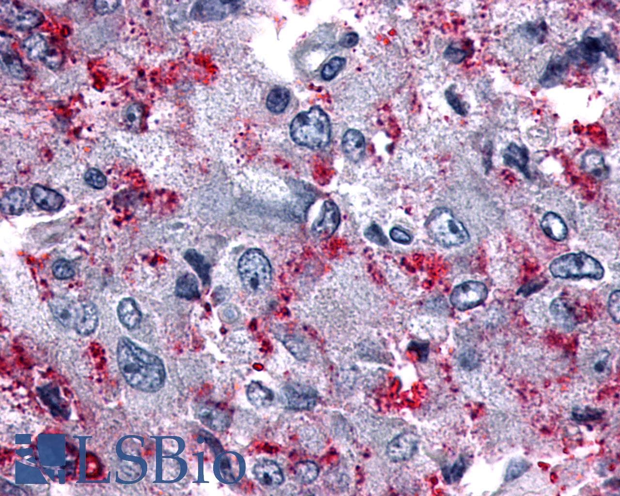 PathPlus™ ADGRF5 / GPR116 Antibody (N-Terminus)