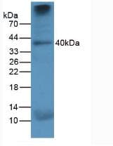 CTSK / Cathepsin K Antibody (Biotin)