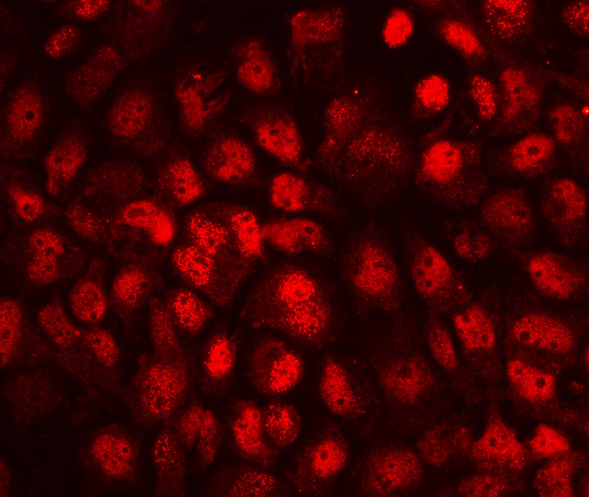 CD79B / CD79 Beta Antibody (aa29-229)