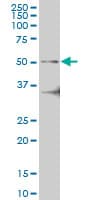 IRAK4 / IRAK-4 Antibody (clone 2D3)