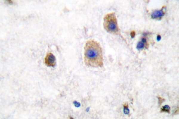 Polyclonal Rabbit anti-Human EFNB3 / Ephrin B3 Antibody (Trp251, IHC)