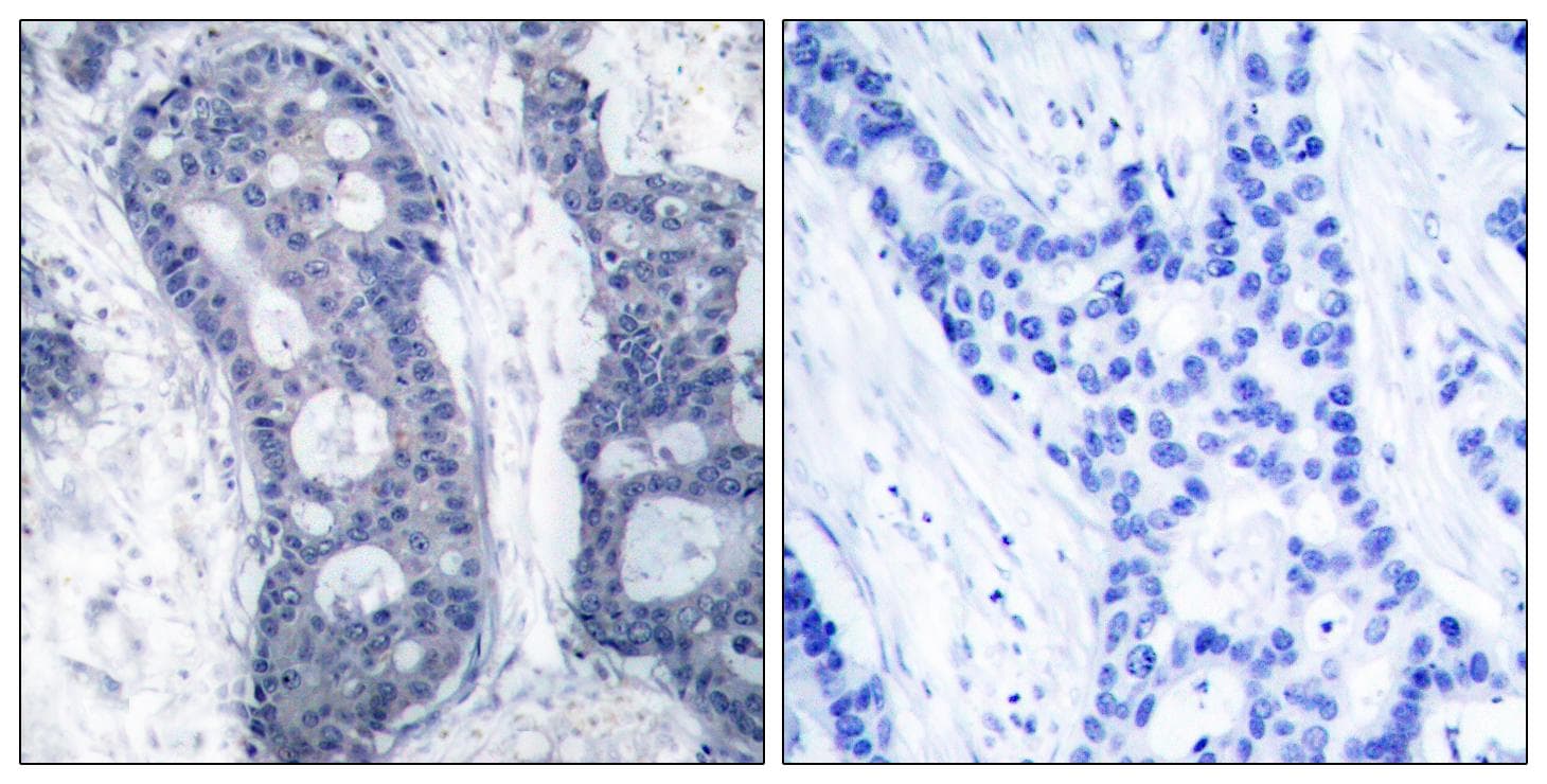 EIF4E Antibody (p209)