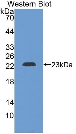 CRYBB2 Antibody (PE)