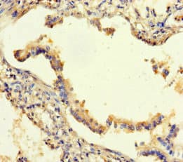 Polyclonal Rabbit anti-Human SEMA5A / Semaphorin 5A Antibody