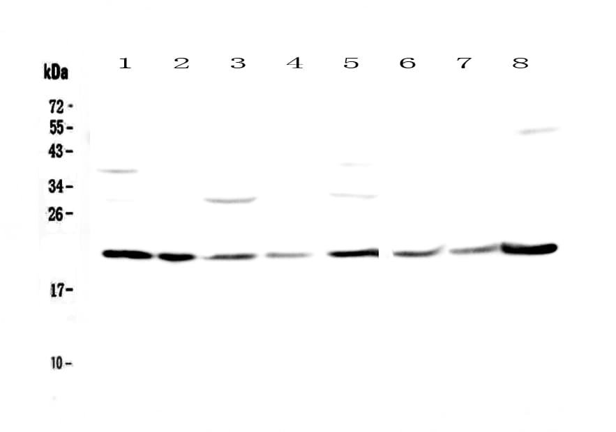 Polyclonal Rabbit anti-Human GLO1 / Glyoxalase I Antibody (IHC, WB)