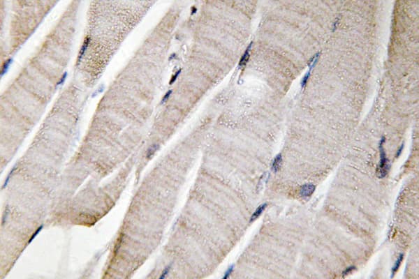DEFA3 / Defensin Alpha 3 Antibody (Ser52)