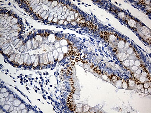 PRELID1 Antibody (aa36-219, clone OTI2A6)