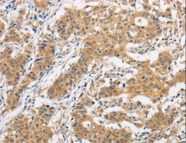 Polyclonal Rabbit anti-Human ITGB3BP Antibody (IHC)