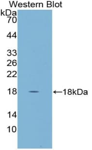 CST5 Antibody (aa21-142)