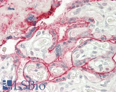 IHC-plus™ PKG / PRKG1 Antibody