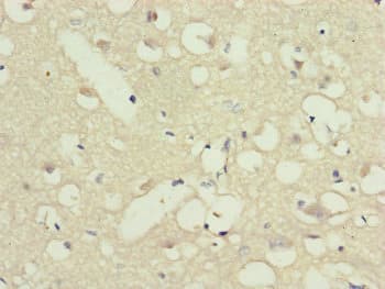 Polyclonal Rabbit anti-Human PPP2R3C Antibody (IHC, WB)