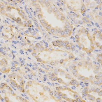 GGA2 Antibody