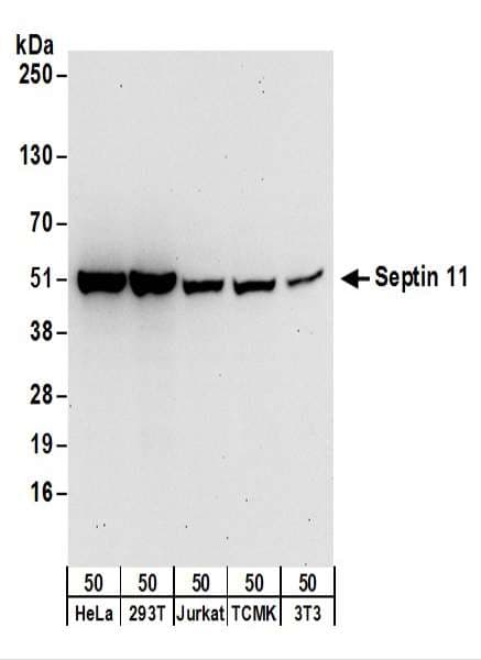 SEPT11 / Septin 11 Antibody (aa379-429)