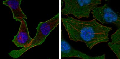 IHC-plus™ Monoclonal Mouse anti-Human CALR3 Antibody (clone 1G6A7, IHC, IF, WB)