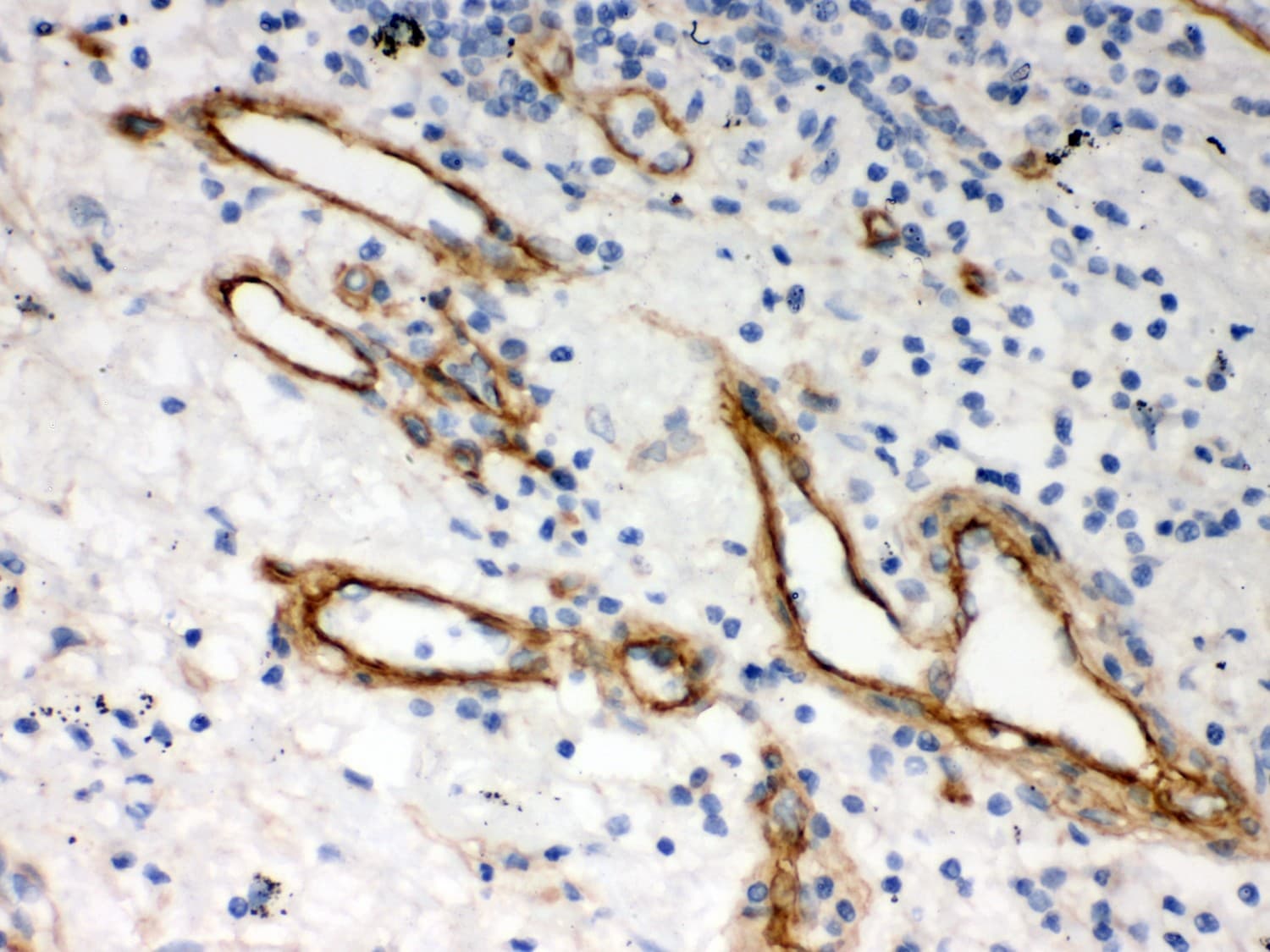 Polyclonal Rabbit anti-Human HSPG2 / Perlecan Antibody (aa524-701, IHC, WB)
