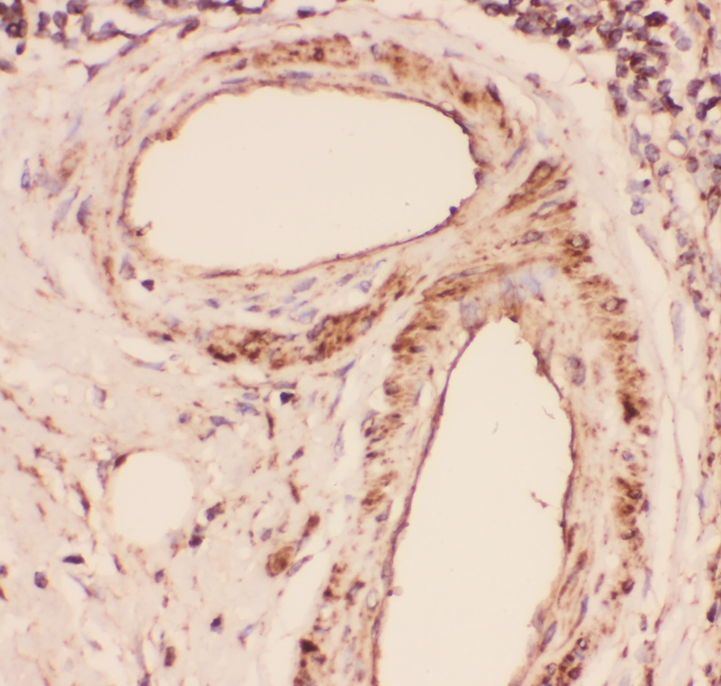 Polyclonal Rabbit anti-Human DES / Desmin Antibody (aa1-304, IHC, WB)