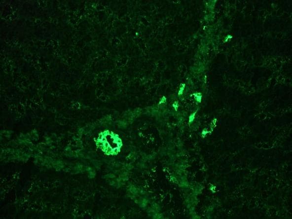 IHC-plus™ KRT7 / CK7 / Cytokeratin 7 Antibody (clone RCK105)