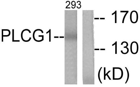 IHC-plus™ Polyclonal Rabbit anti-Human PLCG1 Antibody (aa751-800, IHC, WB)