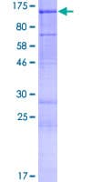 Human RHBDF1 Protein (Recombinant GST)