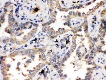 ULK3 Antibody
