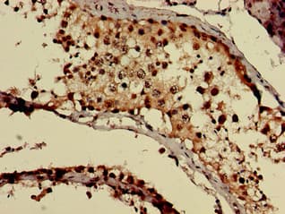 Polyclonal Rabbit anti-Human GNAQ Antibody (IHC, IF)