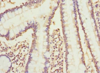 CYP2C18 / CYP2C Antibody