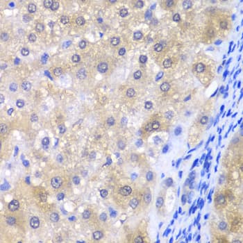 Polyclonal Rabbit anti-Human GPX4 / MCSP Antibody (IHC, IF, WB)