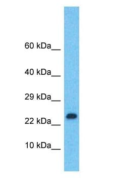 LMO2 Antibody (aa76-125)