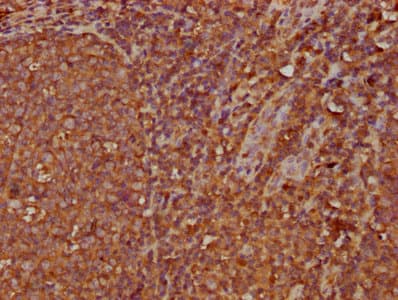 Polyclonal Rabbit anti-Human IGHA2 Antibody (IHC, IF)