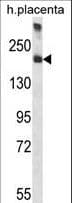 A2M / Alpha-2-Macroglobulin Antibody (aa1162-1192)