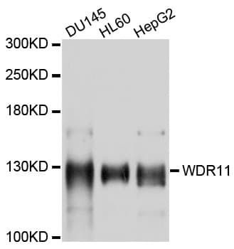 WDR11 / BRWD2 Antibody