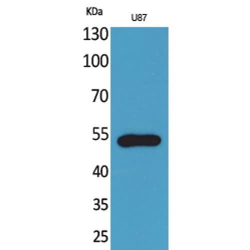 CX3CR1 Antibody (120-200 aa, Internal)