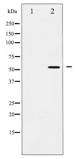 Polyclonal Rabbit anti-Human SMAD2 Antibody (phospho-Ser467, IHC, WB)