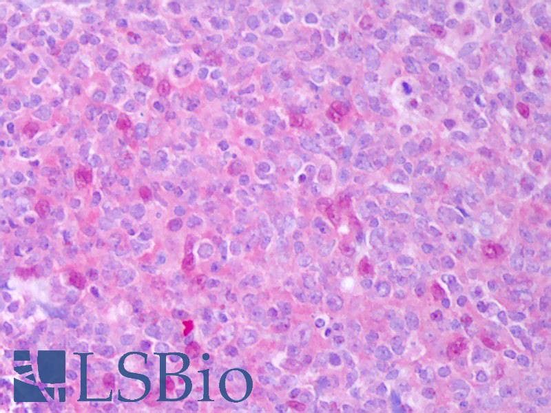 IHC-plus™ Polyclonal Goat anti-Human CD40L Antibody (IHC, WB)